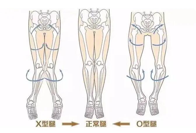 一介粗人·腿型矫正视频教程-吾爱学吧